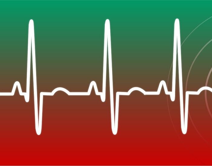 Was ist dein Maximaler Puls?